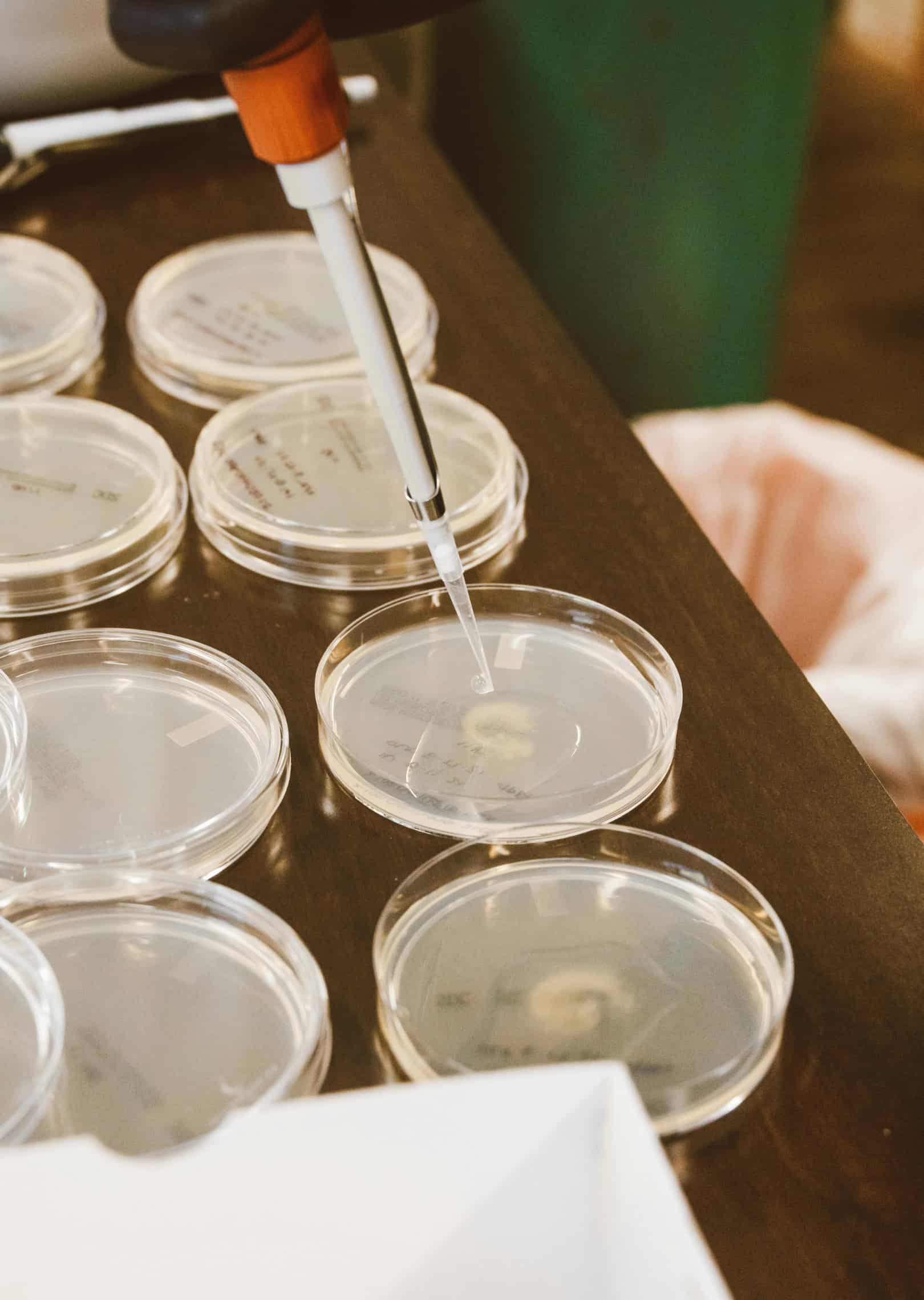 Laboratory sample being prepared in petri dishes during IVF treatment