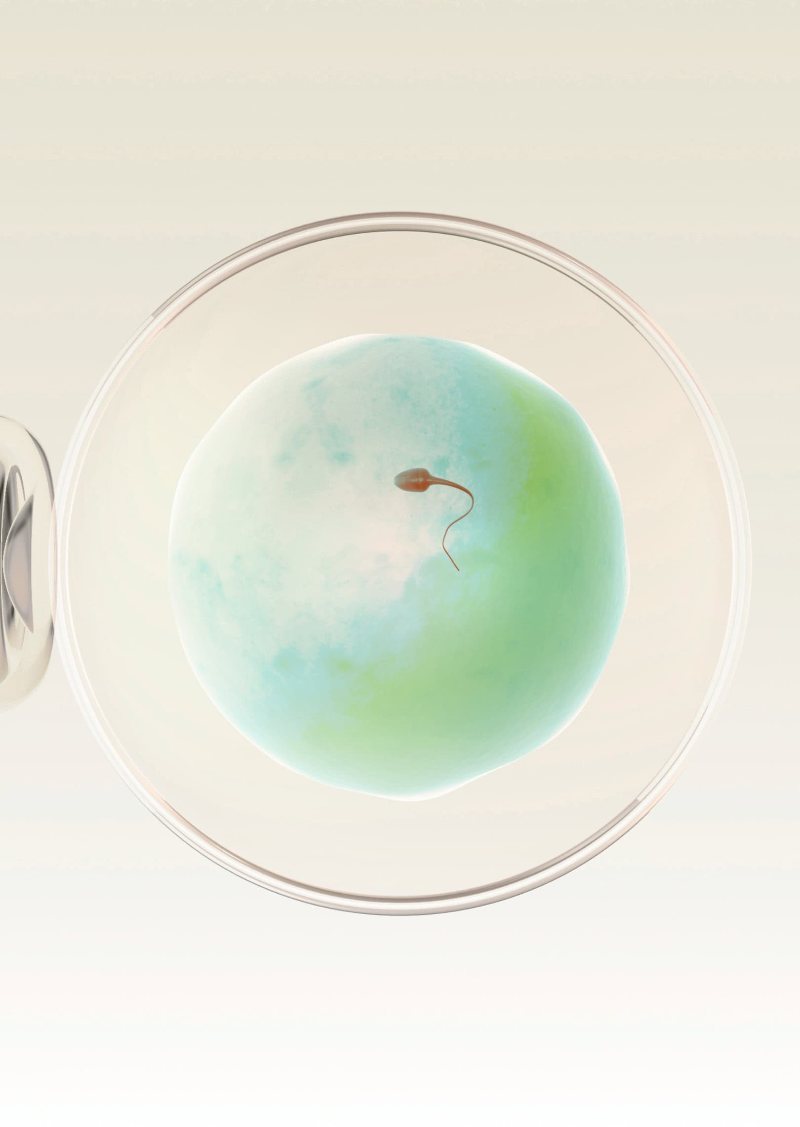Sperm approaching an egg during fertilisation in the IVF laboratory